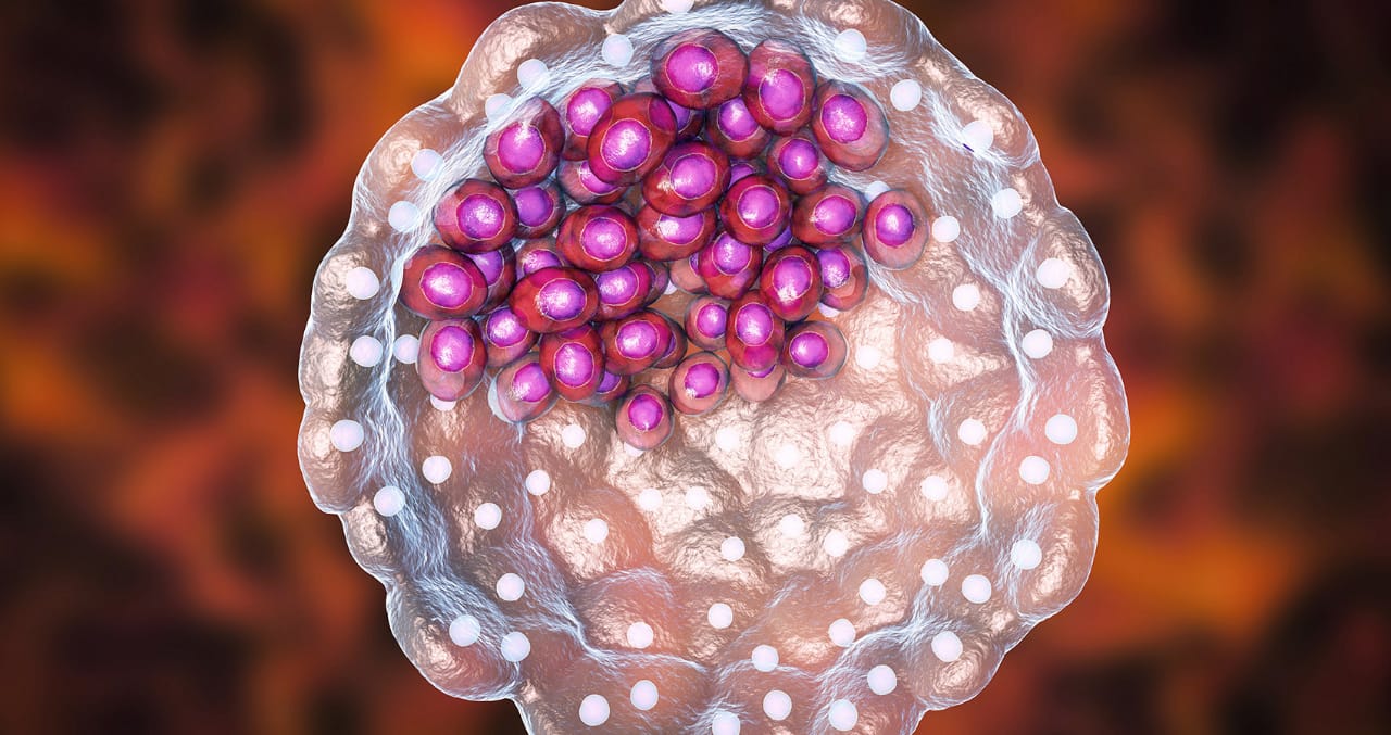 Parto en Casa, bebé recien nacido